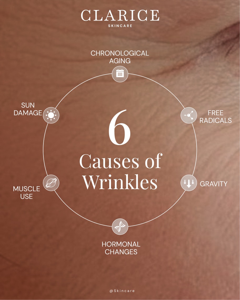 Clarice 6 Causes of Wrinkles